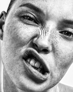 a black and white photo of a person with freckles on his face making a goofy face