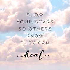 the words show your scars so others know they can heal on a blue sky background