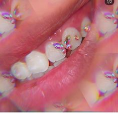 Pink Teeth Gems, Toothgems Aesthetic, Strass Teeth, Heart Teeth Gem, Chandelier Tooth Gem, Slay Aesthetic, Teeth Art