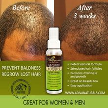 Hair Growth Tips For Men, Hair Regrowth For Men, Regrow Lost Hair, Hair Regrowth Women, Natural Hair Regrowth, Hair Growth Secrets, Rapunzel Hair, Hair Regrowth Treatments, Bathroom Gadgets