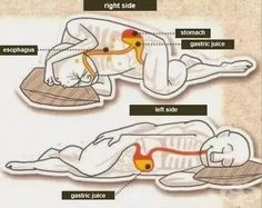 Vic Vaporub, Sleep On Left Side, Gastric Juice, Daily Facts, What Happened To You