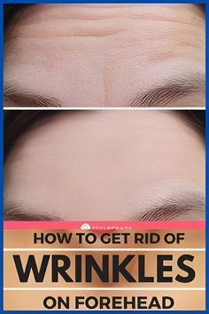 Homemade Wrinkle Remover Cream for Fine Lines: Anti Wrinkle Cream#howtoremovewrinklesfromfaceathome #removewrinkles #wrinkles #getridofwrinklesonface #howtogetridofwrinklesonface #removewrinklesonface Morning Hacks, Remove Dark Spots, Anti Wrinkle Cream, Wrinkle Cream, Wrinkle Remover, Anti Wrinkle, Dark Spots, Wrinkles