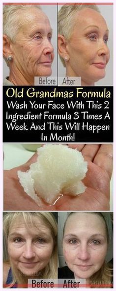 I want you to know how much I value… Wonderful information! Coconut Oil Face Wash, Oil Face Wash, Cucumber Beauty, Coconut Baking, Hacks Makeup, Coconut Oil For Face, Bleaching Cream, 2 Ingredient