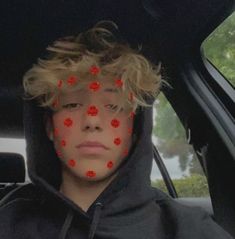 a young boy sitting in the back seat of a car with red dots on his face