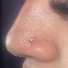 a close up of a person's nose with an acne on the side