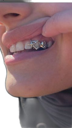 a close up of a person's teeth with braces and piercings on them