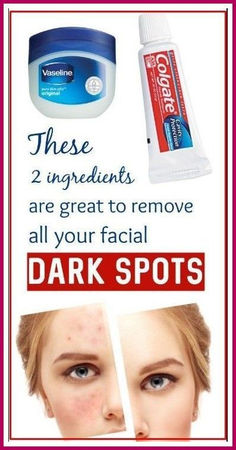 How To Get Rid Of Brown Spots Age Spots On Face, Vaseline Petroleum Jelly, Tongue Health, Dark Spots On Skin, Spots On Face, Remove Dark Spots