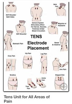 Tens Electrode Placement, Tens Unit Placement, Tens And Units, Tens Machine, Tens Unit, Ten Unit, Back Pain Remedies, Ankle Pain, Sciatic Nerve Pain