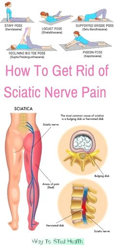 Sciatic Nerve Pain Relief, Sciatica Exercises, Sciatica Pain Relief, Hip Flexor Stretch, Sport Nutrition, Nerve Pain Relief, Trening Fitness, Sciatic Nerve Pain, Knee Pain Relief