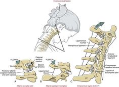 Nervous System Anatomy, Massage Images, Physical Therapy Student, Home Massage