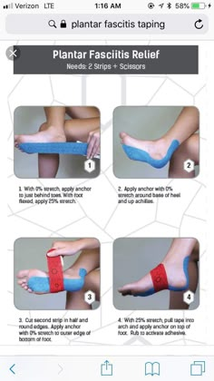 How To Get Rid Of Planters Fasciitis, Planters Fasciitis Taping, Tape Planter Facitis, How To Put Kt Tape On Ankle, Remedies For Planters Fasciitis, Planter Fasciitis Taping, Kt Tape Plantar Facitis, How To Strap An Ankle Injury, Planters Facitis Relief