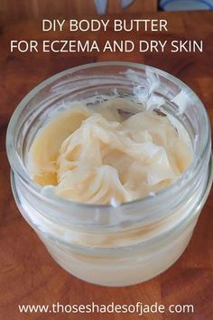 Homemade Body Butter, Diy Body Butter, Body Butters Recipe, Dry Skin Remedies, Homemade Lotion, Skin Remedies, Diy Body, Skin Care Recipes, Diy Skin Care