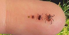 three ticks on a finger with the caption, why you are probably going to get bitten by a tick this summer unless you follow my advice