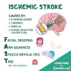 a poster with instructions on how to use an electronic device for the brain and its functions