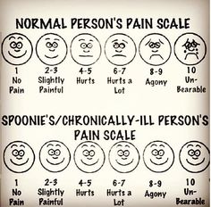 The real pain scale. Guillain Barre, Natural Headache, Pain Scale, Headache Relief