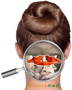 → La realineación del Atlas es ideal para resolver migrañas, dolor de espalda, de cabeza, vértigos Glossopharyngeal Nerve, Punkty Spustowe, Nerf Vague, Sternocleidomastoid Muscle, Nervus Vagus, Parotid Gland, Sleep Positions, Piriformis Muscle, Peripheral Nervous System