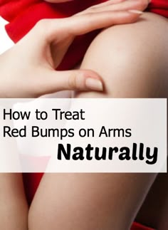 Treat those yucky red bumps on the back of your arms naturally Red Bumps On Arms, All I Want For Christmas, Skin Products, Diy Health