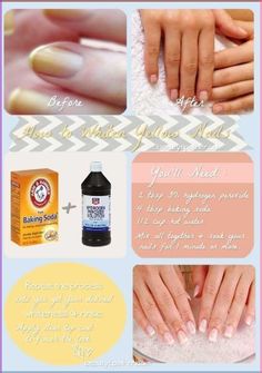 Stained Nails, Nail Whitening, Nail Care Products, Dark Nail Polish, Green Nail Polish, Baking Soda Uses, Finger Tips, Dark Nails