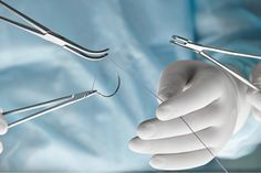 Les sutures chirurgicales peuvent s'infecter et entraîner de graves complications pour les patients. La détection des infections dans les incisions refermées doit se faire très tôt. Cela permet aux soignants d'appliquer les traitements nécessaires pour éviter une complication. Passionnée de science et de médecine, Dasia a ainsi travaillé sur un moyen plus abordable de détecter ces infections à un stade précoce. #recherchemédicale Surgery Aesthetic, Doctor Aesthetic, Eye Doctor, Science