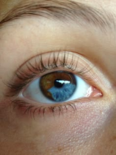 Sectoral Heterochromia, Heterochromia Iridum, Kat Diy, Parts Of The Eye