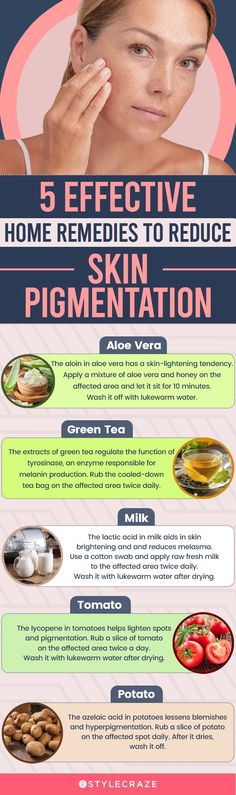 14 Best Home Remedies For Skin Pigmentation & Prevention Tips Skin Care Hyperpigmentation, Home Remedies For Skin, Dark Spots On Face, How To Get Rid Of Pimples, Dark Spots On Skin, Receding Gums, Diy Skin Care