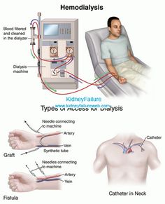 the diagram shows how to use an oxygen machine