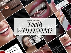 Teeth Whitening Posts | Teeth Whitening Social Media Post Template | Tooth Gem Instagram Templates |  * BOOKED & BUSY - Don't spend countless hours creating your own Instagram posts from scratch when you can be doing what you do best; TEETH WHITENING. Save time and money with these editable luxury esthetician TEETH WHITENING Instagram posts. * READY MADE CONTENT - Used for any Teeth Whitening business such as Medspas, Dental Offices, Estheticians, Dental Branding, Or any Luxury Beauty related service looking to elevate their social media game. * TYPES OF CONTENT - TEETH WHITENING Informational Posts, Teeth Whitening Tips, Tooth Gems, Teeth Whitening Services, Teeth Whitening Grid, Discount On Products, Sale For A Product Or Service, Last Minute Booking Posts, Teeth Whitening Flyer, Teeth W Teeth Whitening Business Flyer, Teeth Whitening Business Aesthetic, Luxury Esthetician, Teeth Whitening Business, Med Spa Marketing, Dental Branding, Spray Tan Business, Dental Offices, Spa Marketing