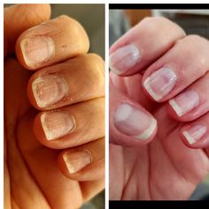 Strengthening Nail Polish, Do It Yourself Nails, Brittle Nails