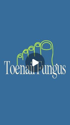 Phil Cowley | Philsmypharmacist on Instagram: "Easy and effective toenail fungus hack! 

Comment- “Fungus” and I’ll dm you the recipe + shopping list! 

#philsmypharmacist #toenailfungus #pharmacyhacks #healthandwellness #healtheducation #pharmacist" Medical Remedies, Traditional Irish Soda Bread, Medical Tips, Irish Soda, Toenail Fungus, Soda Bread, Apartment Life, Alternative Health, Health And Beauty Tips