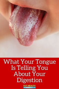 What Your Tongue Is Telling You About Your Digestion | Digestive Health | Holistic | http://guthealthproject.com/what-your-tongue-is-telling-you-about-your-digestion/ Leaky Gut, Health Wellbeing, Health Information, Reflexology, Health Exercise, Healthy Ideas, Health Matters, Health Facts, Chinese Medicine