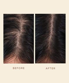 Serum For Hair, Hair Growth Women, Type 4 Hair, Thinning Hair, Roots Hair