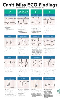 Medische Humor, Cardiology Nursing, Nursing School Studying