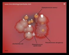 the structure of an organ is shown in this image, with labels on each side