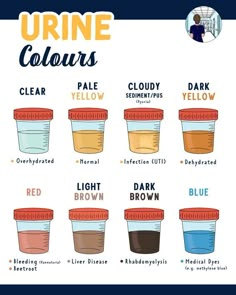 the different types of urine colors in each jar are labeled with their names and abbreviations