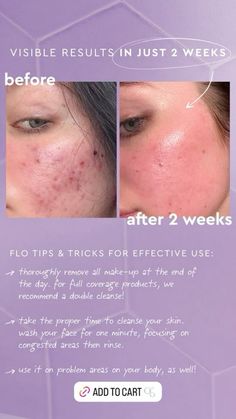 Florence By Mills, July 28, Wash Your Face, Insta Story, Florence, Skin Care, Skin