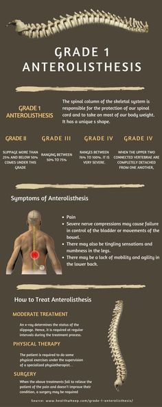 Lumbar Exercises, The Skeletal System, Cervical Disc, Spinal Column, Bulging Disc, Hip Problems, Aging Backwards, Tight Hip Flexors, Skeletal System