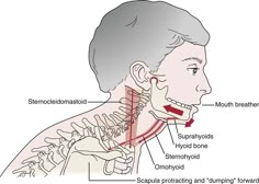 Hyoid Bone, Tmj Relief, Face Muscles, Forward Head Posture, Jaw Pain, Nerve Pain