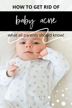 how to get rid of baby acne Baby Acne Remedy How To Get Rid Of, Cold Remedies For Babies, Cough And Cold Remedies, Baby Acne Remedy, Newborn Acne, Sick Baby Remedies, Home Remedies For Cough, Remedies For Cough