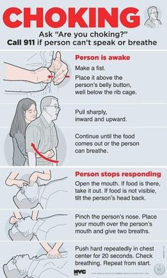 Heimlich Maneuver, First Aid Tips, Survival Skills Life Hacks, Medical School Essentials, Survival Life Hacks, Apocalypse Survival, Survival Techniques, Survival Life, Medical Knowledge