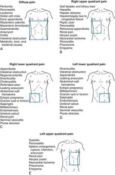 the diagram shows different types of muscles and how they are used to help you understand them