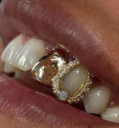 Front Tooth Grill, Colorful Grillz, Grills For Gap Teeth, Two Tooth Grillz, Grill Design Teeth, Bottom Grillz For Women, Women’s Grills, Grillz For Females Aesthetic, Gold Grill Women