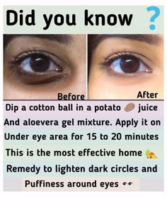 Beauty Hacks Dark Circles, Dark Circle Remedies, Membentuk Alis, Healthy Food Ideas, Health Aesthetic, Aesthetic Health, Health Art, Eye Skin Care