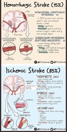 an info sheet showing the different types of medical devices in each region of the body