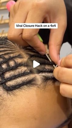 Behind Hairline Closure, Braid Down For Wig Install, Best Braiding Hair For Knotless Braids, Behind The Hairline Closure, Closure Behind Hairline, Wig Braid Down Pattern, Bad Hairline, Closure Install, Traction Alopecia