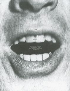 a black and white photo of a person's mouth with braces on it