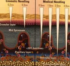 How Deep Should You Be Microneedling? – demystifying skincare with science Microneedling Depth Chart, Microneedling Video, Microneedling Aesthetic, Microneedling At Home, Microneedling Serum