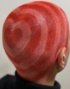 Pattern Hair, Bald Hair