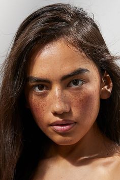 a woman with freckles on her face looking at the camera