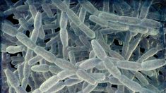 Donated organs likely caused Legionnaires' disease in 2 lung transplant recipients: CDC Pneumonia Causes, Chronic Lung Disease, Hot Water Tanks, Gastrointestinal Disease, Lung Transplant, Organ Donor, Heart And Lungs, Lung Disease, Science Photos