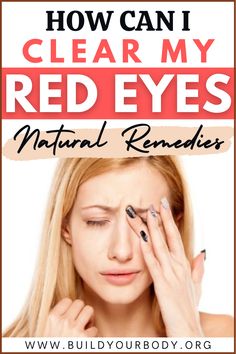 In this article, you'll know how can you clean your red eyes with the use of natural remedies. Red, tired eyes are usually the product of multiple causes. Vision disorders are the first cause of eye fatigue and redness. Also, red eyes usually occur by mild or more severe factors, such as excessive use of the screen of your pc, lack of rest, dry eyes, some allergies, etc. Find out more! #eyes #redeyes #dryeyes #eyeremedies #naturalremedies Home Remedies For Skin, Bloated Belly, Diy Remedies, Beauty Remedies, Tired Eyes, Dry Eyes, Natural Home Remedies